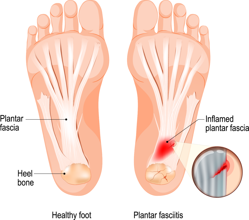 Vascular & Interventional Specialists of Kansas City