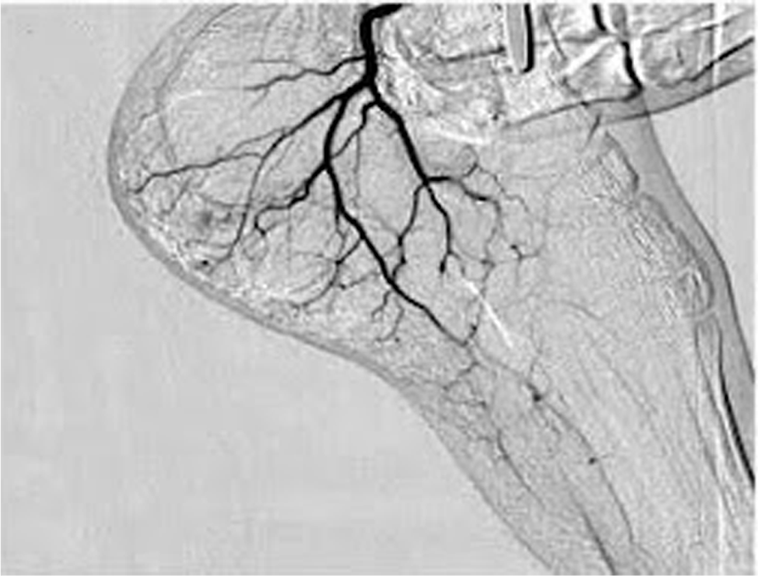 Vascular & Interventional Specialists of Kansas City