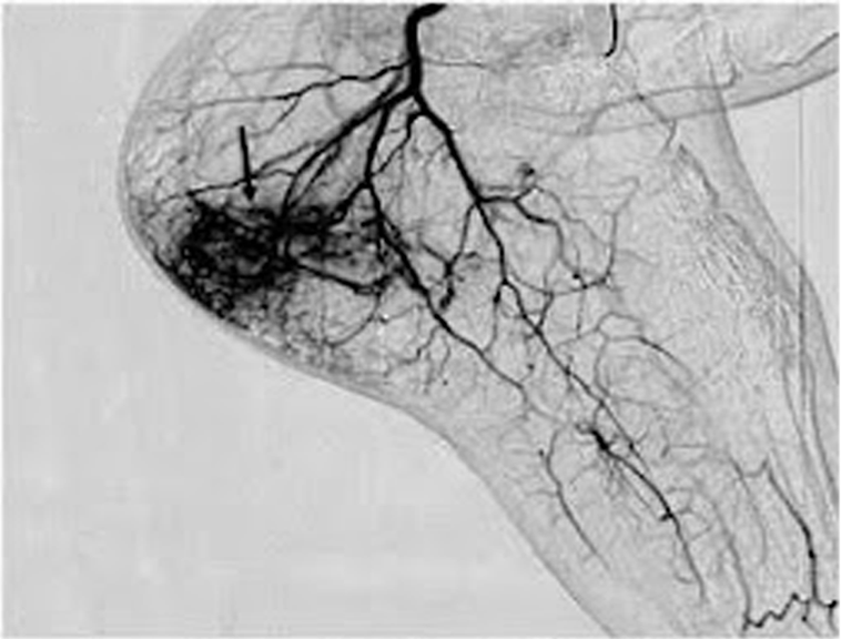 Vascular & Interventional Specialists of Kansas City